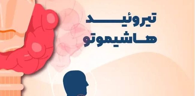 علایم یک بیماری خودایمنی شایع بر اثر اختلالات تیروئیدی را بشناسید